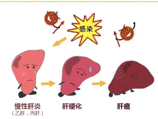 麻豆操逼网站廠家提醒肝髒疾病治不好？要了解是否含鐵食物攝入多